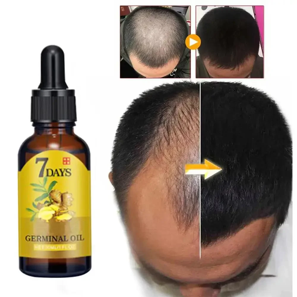 Beard Oil Growth - Crescita dei capelli Zenzero Capelli a
