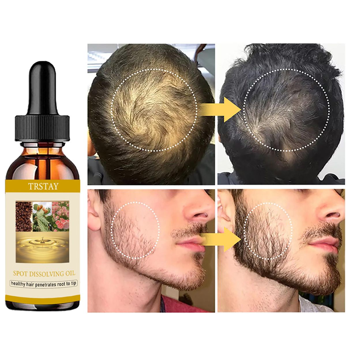 50ML Olio per la crescita dell - Beard Oil Growth recensione e prezzo